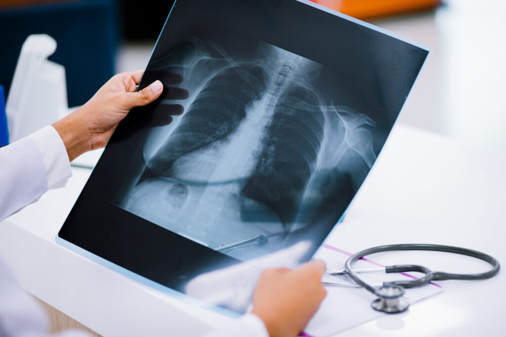 X-Ray